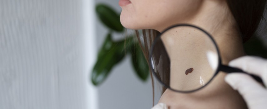 cancer-de-pele-lidera-incidencia-no-brasil